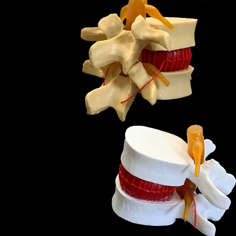 กายวิภาคของมนุษย์ Lumbar Verte - Examination Bed Medical บทวิจารณ์และราคา