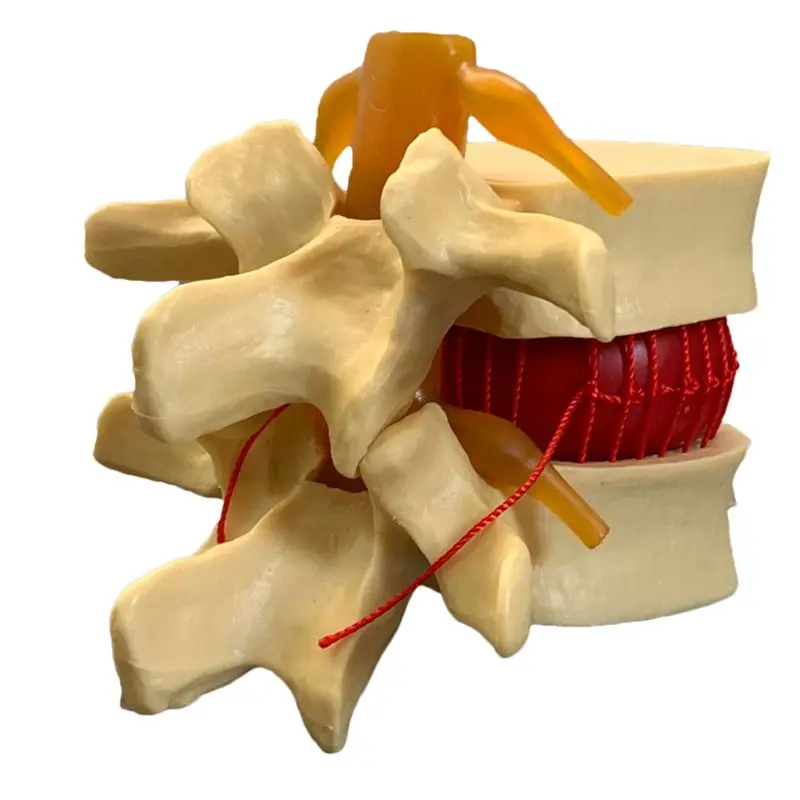 กายวิภาคของมนุษย์ Lumbar Verte - Examination Bed Medical บทวิจารณ์และราคา