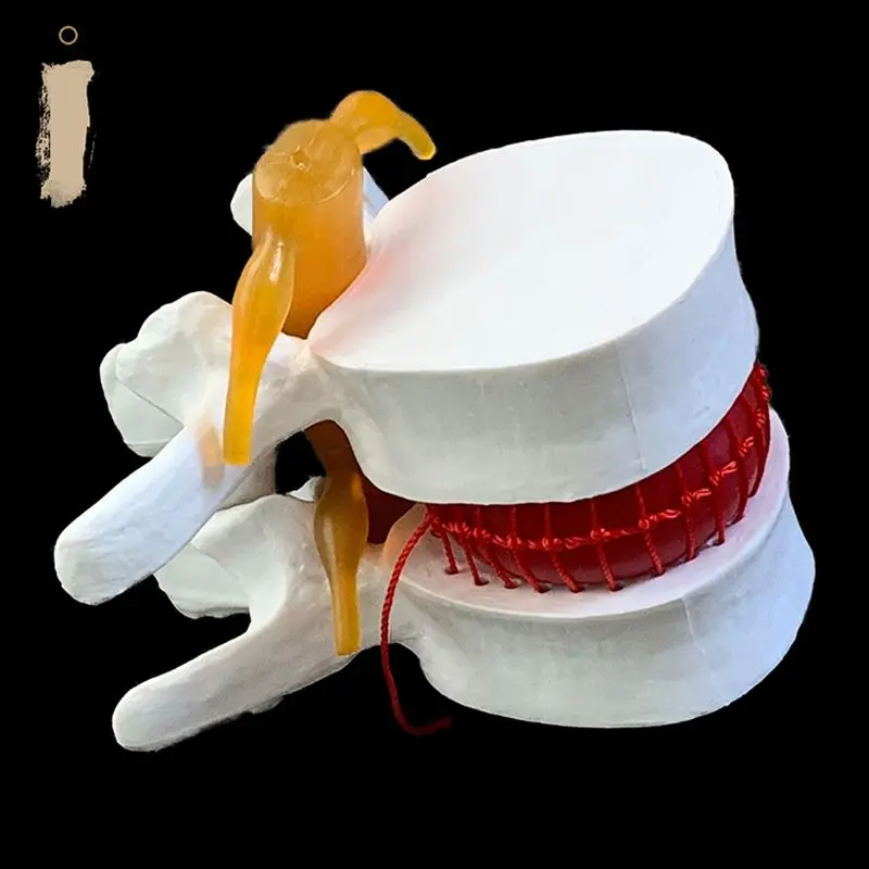 กายวิภาคของมนุษย์ Lumbar Verte - Examination Bed Medical บทวิจารณ์และราคา