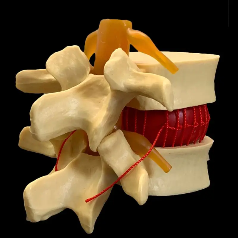 กายวิภาคของมนุษย์ Lumbar Verte - Examination Bed Medical บทวิจารณ์และราคา